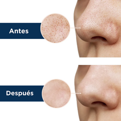 Bandas Adhesivas para Puntos Negros Clean Face ®